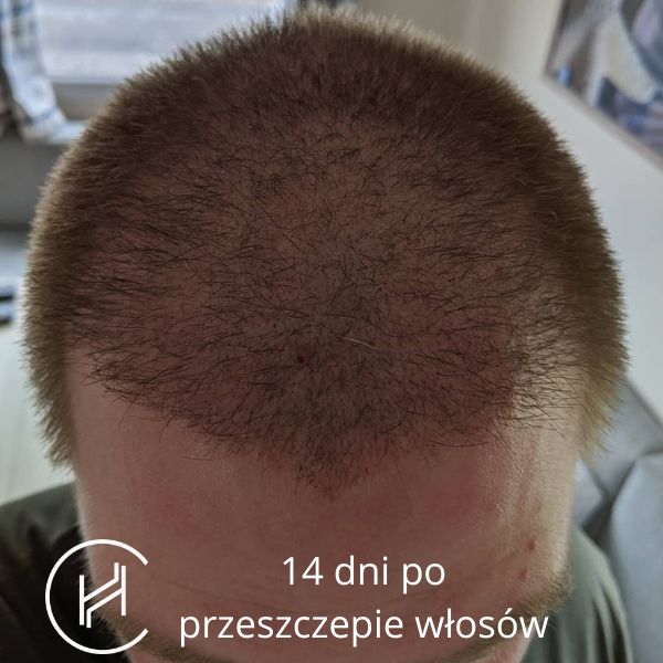 lakier do włosów syoss keratin opinie