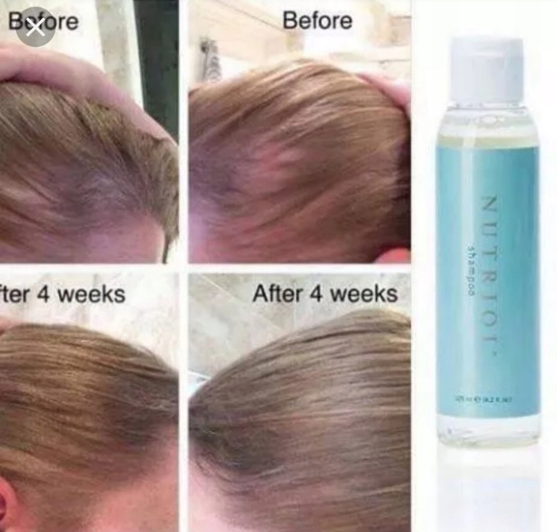 nu skin szampon na porost włosów