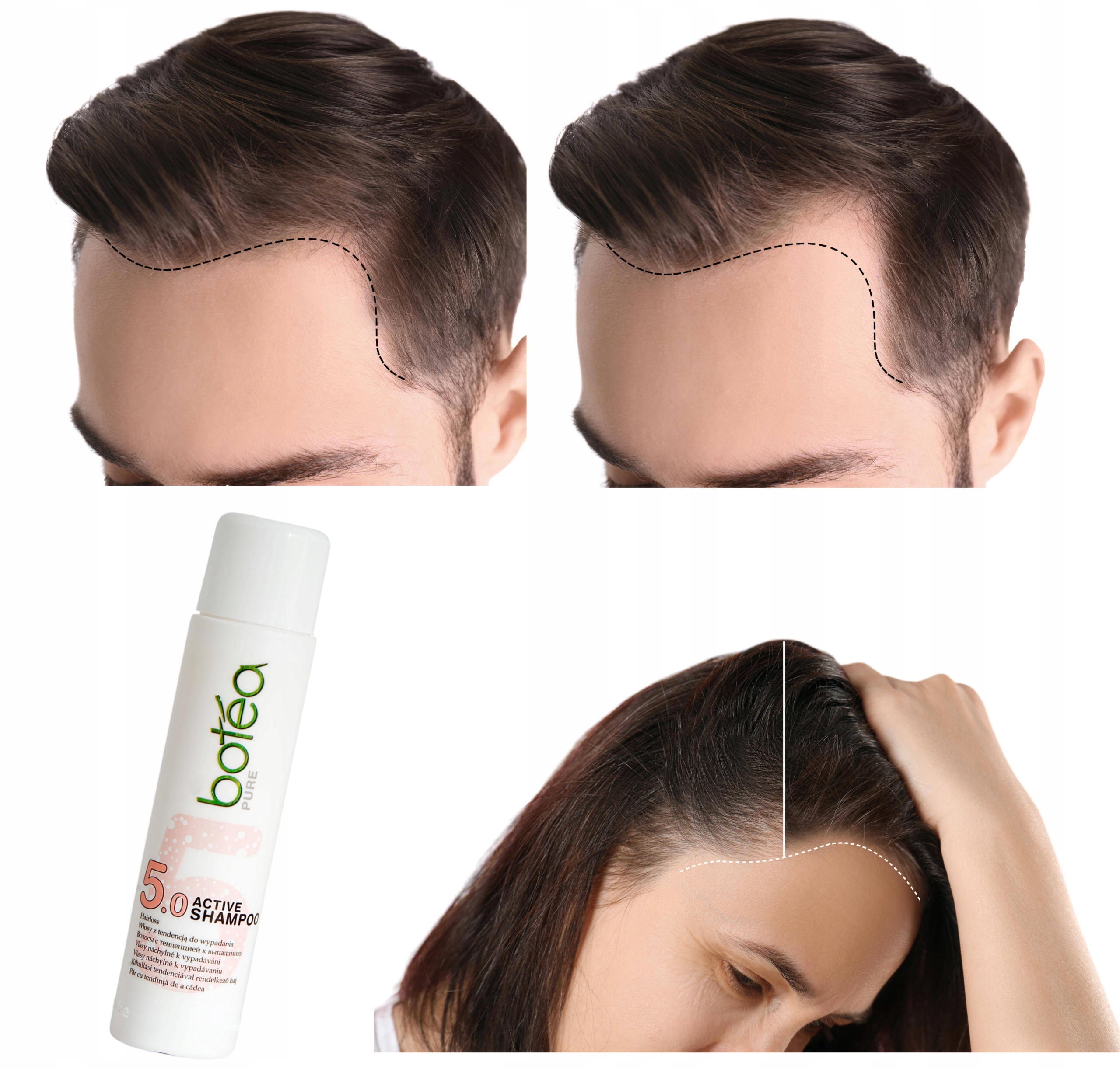 szampon przeciw wypadaniu włosów 5.0
